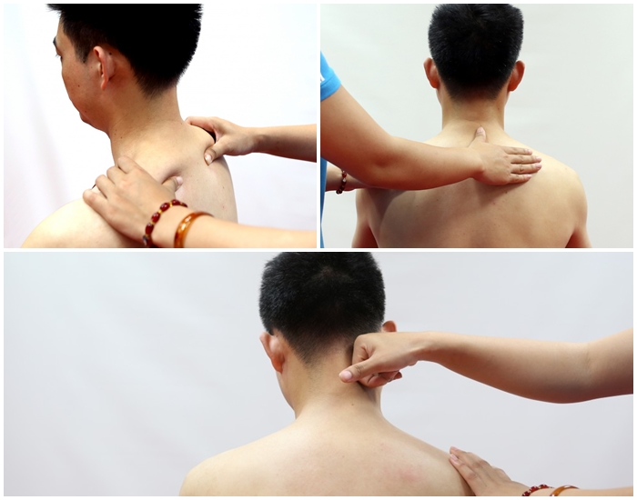 Bấm huyệt điều trị thoái hóa đốt sống cổ